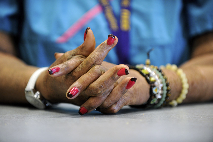 Lions Burn Care Center at UMC treats severely burned patients Las