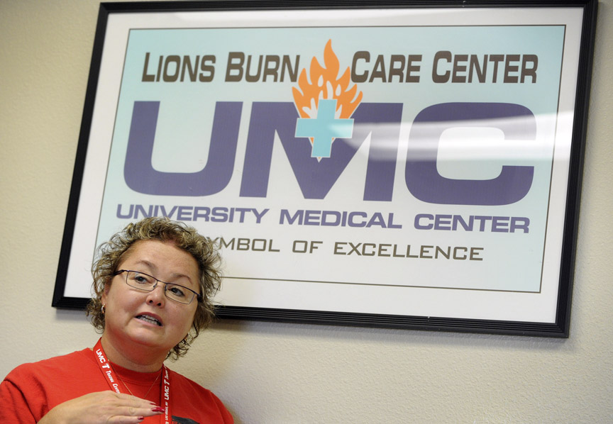 Lions Burn Care Center at UMC treats severely burned patients Las