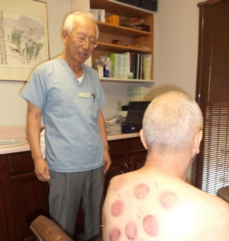 Dr. Sae Eun-Lee uses cupping therapy to treat a patient with bronchitis.