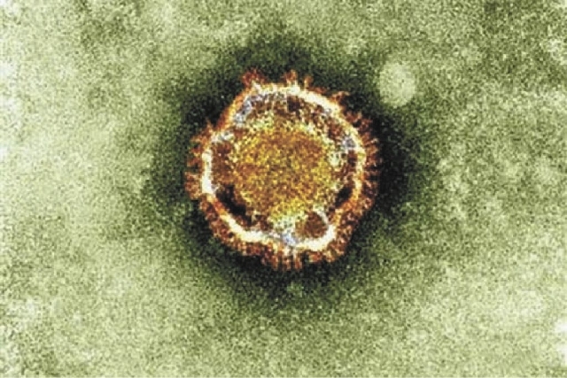 In this undated file image released by the British Health Protection Agency shows an electron microscope image of a coronavirus, part of a family of viruses that cause ailments including the commo ...