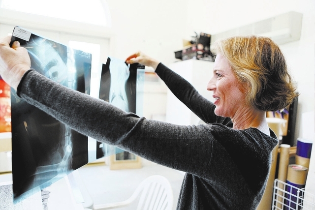 Linda Alterwitz holds up canine x-rays, which she uses in her artwork, at her home studio Nov. 26, 2013, in Las Vegas. Alterwitz is a visual artist skilled in photography, digital work and paintin ...