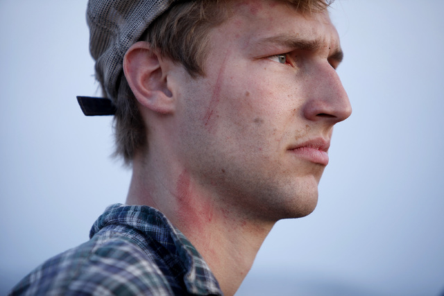 Scratches can be seen on the face and neck of Spencer Shillig at the Lake Mead National Recreation Area near Overton, Nev. Thursday, April 10, 2014. Shillig and his brother Tyler Shillig were deta ...