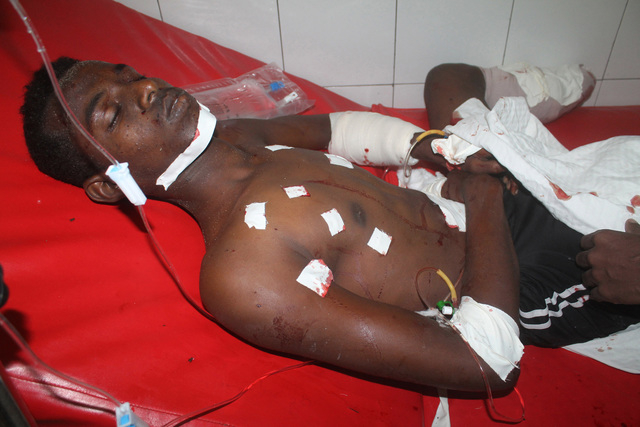 An injured Somali man is treated at Darul-Shifa hospital after he was wounded by a car bomb which exploded near the parliament, in Mogadishu, Somalia, Saturday, July 5, 2014. A Somali police offic ...