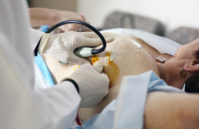 Lumpectomy works to rid cancer, preserve breast | Las Vegas Review-Journal