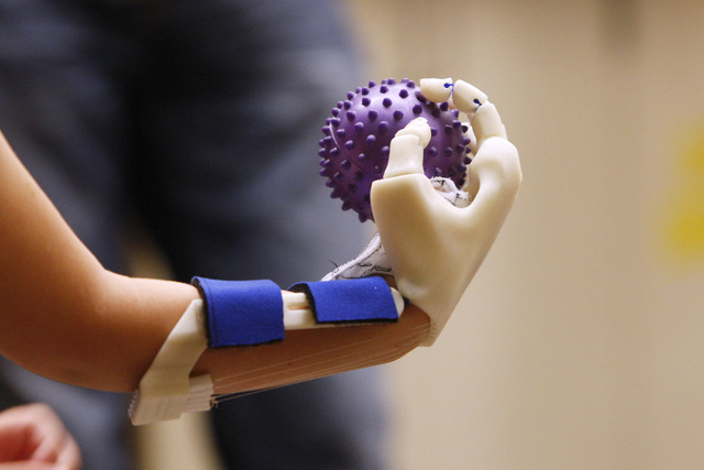 Hailey Dawson grips a rubber ball with her new prosthetic hand, which was made by a team of UNLV engineers, Thursday, Oct. 30, 2014 at UNLV. (Sam Morris/Las Vegas Review-Journal)