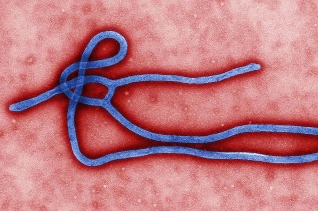 The Ebola virus. (Courtesy)