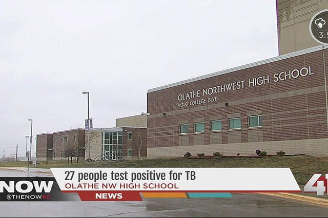 Twenty-seven people have tested positive for tuberculosis at a suburban Kansas City high school where a student was recently found to have an active case. (KSHB- Kansas City, MO/NDN)