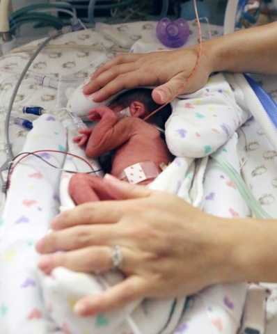 Silvia Farra touches her premature son, Dougie, who was placed inside an incubator at Spring Valley Hospital on Thursday, Sep. 3, 2015. BIZUAYEHU TESFAYE/LAS VEGAS REVIEW-JOURNAL FOLLOW HIM @BIZUT ...