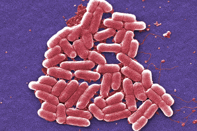 This 2006 colorized scanning electron micrograph image made available by the Centers for Disease Control and Prevention shows the O157:H7 strain of the E. coli bacteria. On Wednesday, May 26, 2016 ...