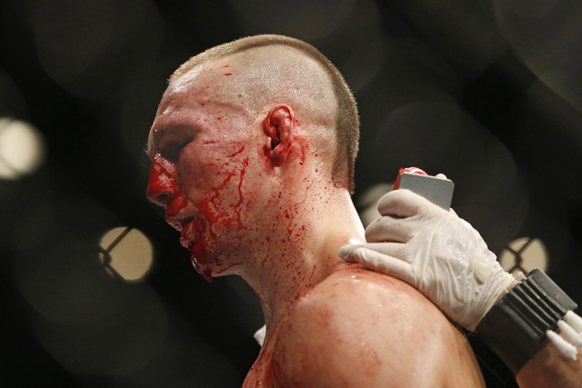 Rory MacDonald between rounds against Robbie Lawler during their welterweight title fight mixed martial arts bout at UFC 189 Saturday, July 11, 2015, in Las Vegas. (AP Photo/John Locher)