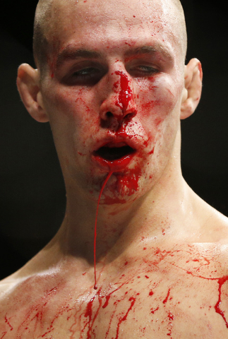 Rory MacDonald between rounds against Robbie Lawler during their welterweight title fight mixed martial arts bout at UFC 189 Saturday, July 11, 2015, in Las Vegas. (AP Photo/John Locher)