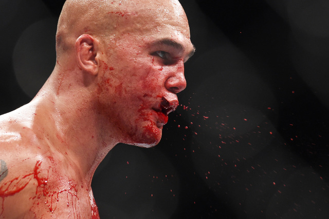Robbie Lawler spits blood from a split lip during his welterweight title fight against Rory Macdonald at UFC 189 Saturday, July 11, 2015 at the MGM Grand Garden Arena in Las Vegas, Nevada. Lawler  ...