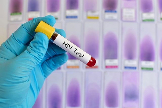 Blood sample for HIV testing (Thinkstock)