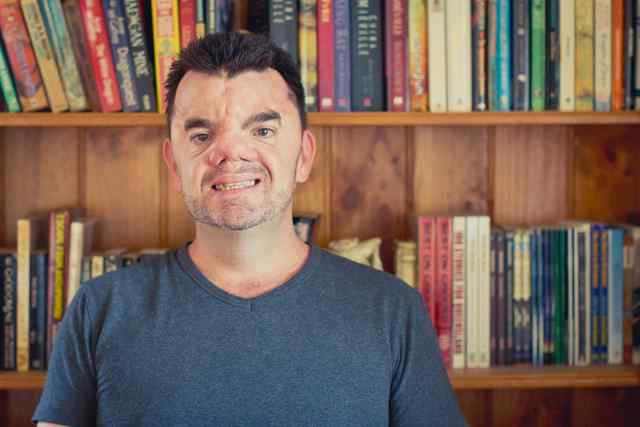 Robert Hoge shares his story in the new book “Ugly.” Matt Warrell/Special to View