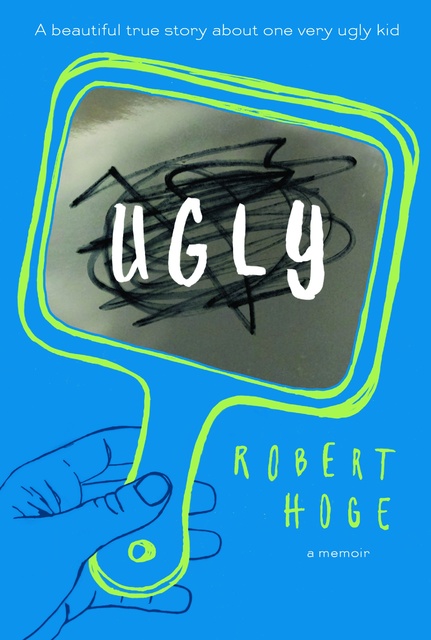 Robert Hoge shares his story in the new book “Ugly.” Special to View