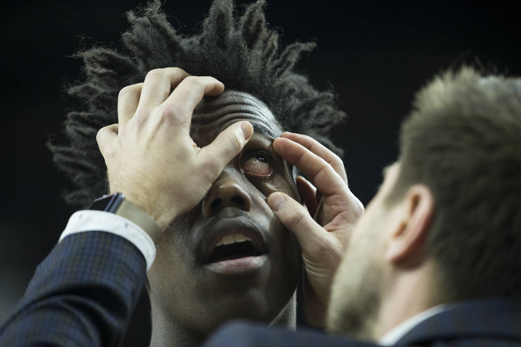 Stanford Cardinal guard Marcus Allen (15) gets his eye checked after taking a hit during a play against Arizona State Sun Devils in the Pac-12 Men's Basketball Tournament game at T-Mobile Arena on ...