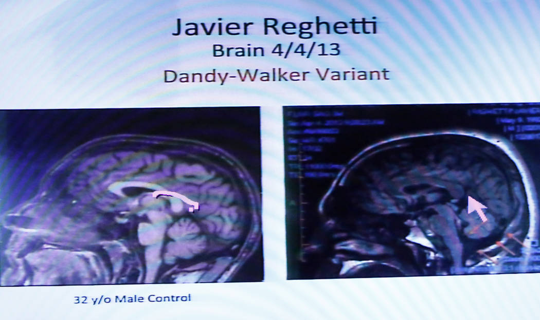 A CAT scan of the brain of Javier Righetti is displayed at the Regional Justice Center on Tuesday, March 21, 2017, during the penalty phase of Righetti's murder trial in Las Vegas. Righetti was co ...