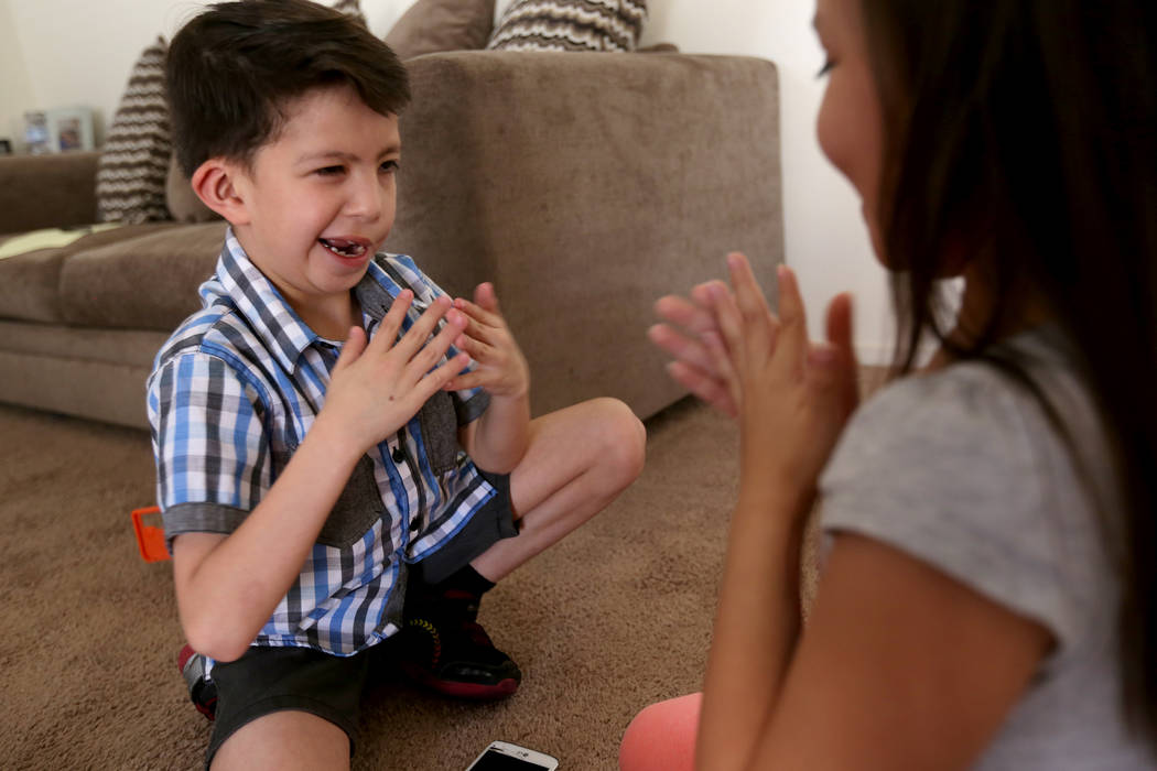 Abraham Chavez, 8, plays with his twin sister Aiden Chavez at their home on Sunday, March 19, 2017, in Las Vegas. Abraham recently had surgery to make it possible for him to smile. He was born wit ...