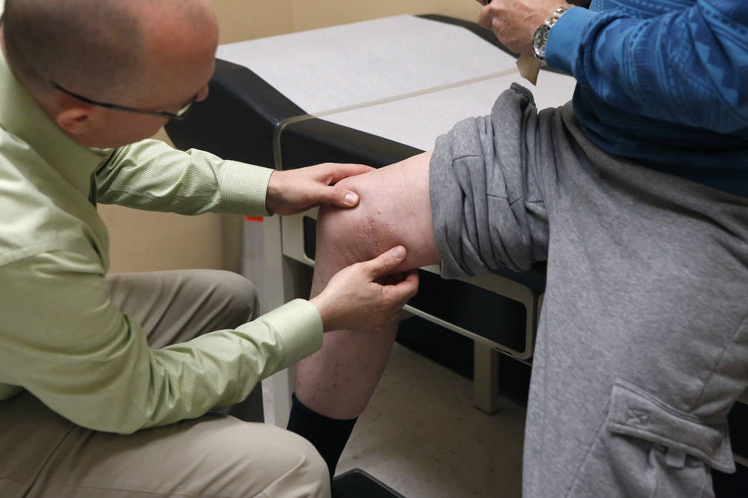 Dr. Tim Tollestrup, left, inspects Mark Kline's knee on Wednesday, March 29, 2017, in Henderson. Tollestrup performed a surgery on the knee. (Christian K. Lee/Las Vegas Review-Journal) @chrisklee_jpeg