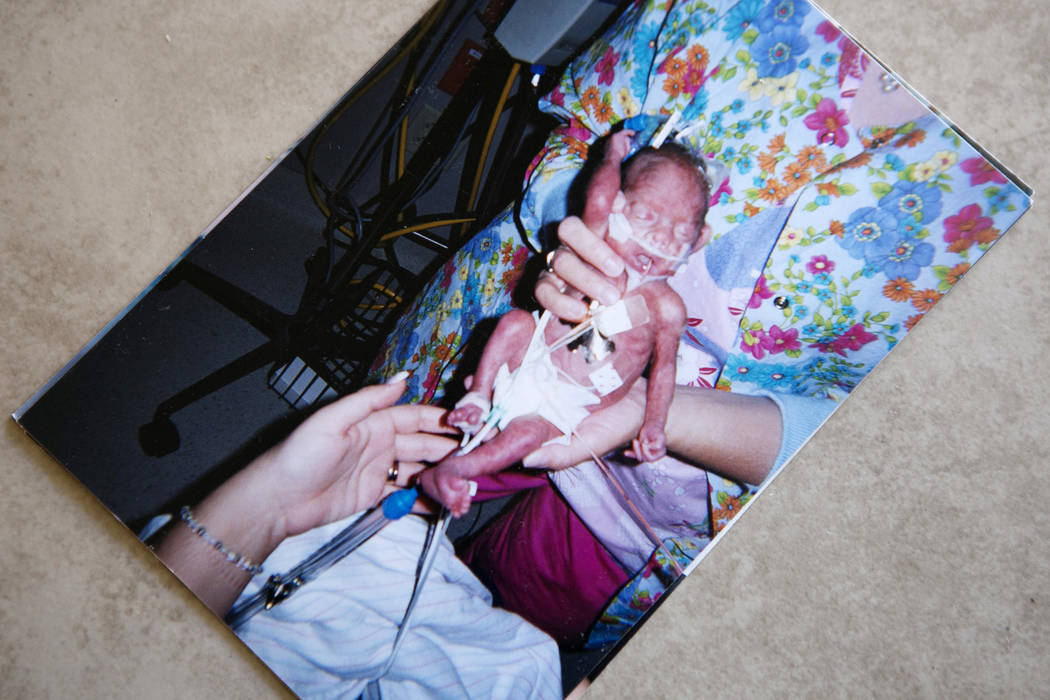 A picture of Zareh Shamirza as a child is seen a the family's home on Thursday, May 11, 2017, in Las Vegas. Zareh was born 24 weeks early due to circumstances involved with a medical condition mot ...