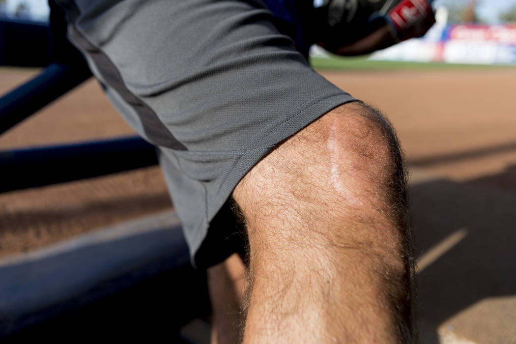 Las Vegas 51s pitcher Beck Wheeler's knee still has a scar   from a boating accident in 2007, at Cashman Field in Las Vegas, Wednesday, July 5, 2017. Elizabeth Brumley Las Vegas Review-Journal