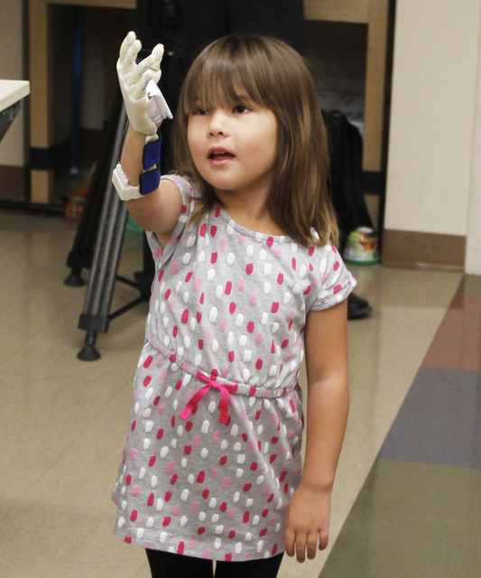 Hailey Dawson examines her new prosthetic hand, which was made by a team of UNLV engineers, Thursday, Oct. 30, 2014 at UNLV. (Sam Morris/Las Vegas Review-Journal)