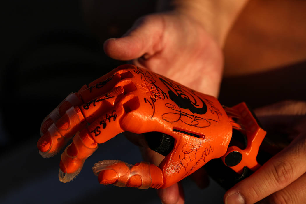 Yong Dawson, 48, of Henderson holds her daughter's 3-D printed prosthetic hand at Sunset Park in Las Vegas, Thursday, Oct. 5, 2017. Her daughter, Hailey Dawson, 7, was born with Poland syndrome le ...
