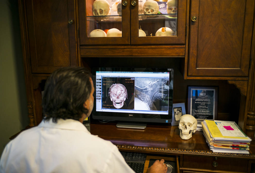 Dr. Keith Blum, a neurosurgeon who was on call at Sunrise Hospital and Medical Center the night of the mass shooting, looks at brain scans of patient Tina Frost at his office in Las Vegas on Wedne ...