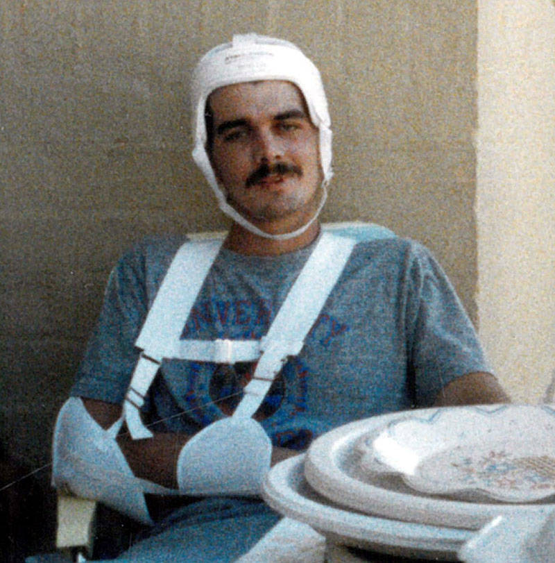 Pat Rose, 22 at the time, wears a helmet after suffering a serious brain injury in the PEPCON explosions. Rose was required to wear the helmet until doctors placed a metal plate in his head. (cour ...