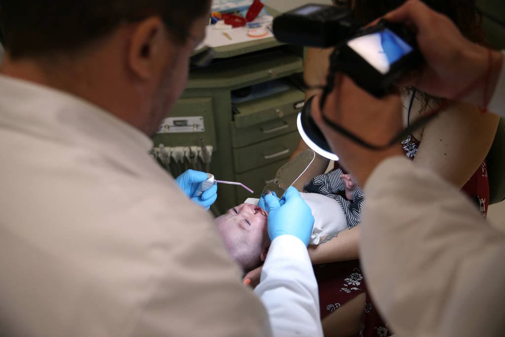 Dr. Glen Roberson, an orthodontist at the Orthodontic Clinic at Roseman University, checks the mouth of Blake Muschong, a 10-week-old baby who used the nasoalveolar molding (NAM) appliance, at the ...