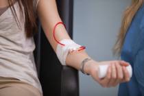 Giving blood. (Thinkstock)