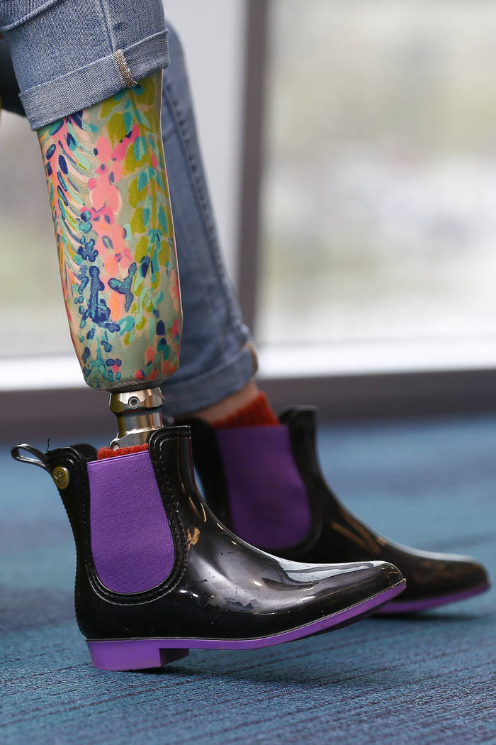 In this Wednesday, Feb. 20, 2019 photo, Lily Silverstein, of Paducah, Ky., a National Patient Ambassador for Shriners Hospitals for Children shows her prosthetic leg at Shriners Hospitals for Chil ...