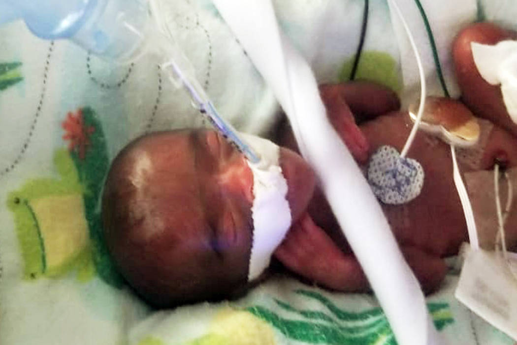 This December, 2018 photo provided by Sharp HealthCare in San Diego shows a baby named Saybie. ...