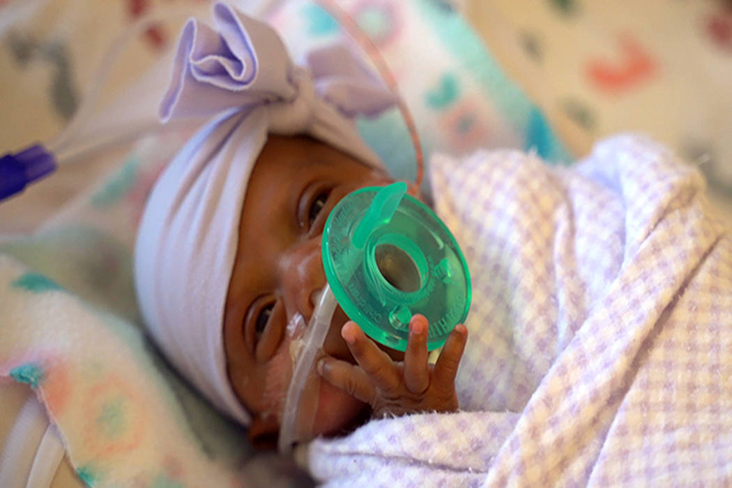 This March, 2019 photo provided by Sharp HealthCare in San Diego shows a baby named Saybie. Sha ...