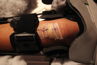 With his leg in a rehabilitation machine designed to increase range of movement, Lake Mead C ...
