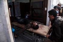 A man wounded in Turkish shelling is brought to Tal Tamr hospital in north Syria, Monday, Oct. ...