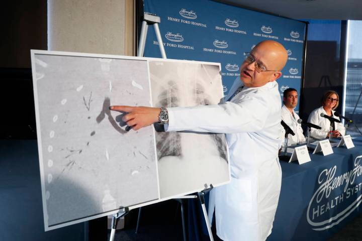 Dr. Hassan Nemeh, Surgical Director of Thoracic Organ Transplant, shows areas of a patient's lu ...