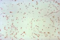 A 1971 microscope image made available by the Centers for Disease Control and Prevention shows ...