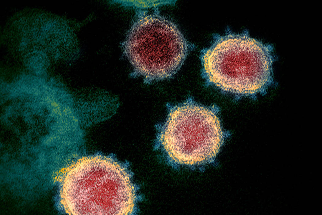 This image shows the novel noronavirus SARS-CoV-2. (NIAID-RML via AP)