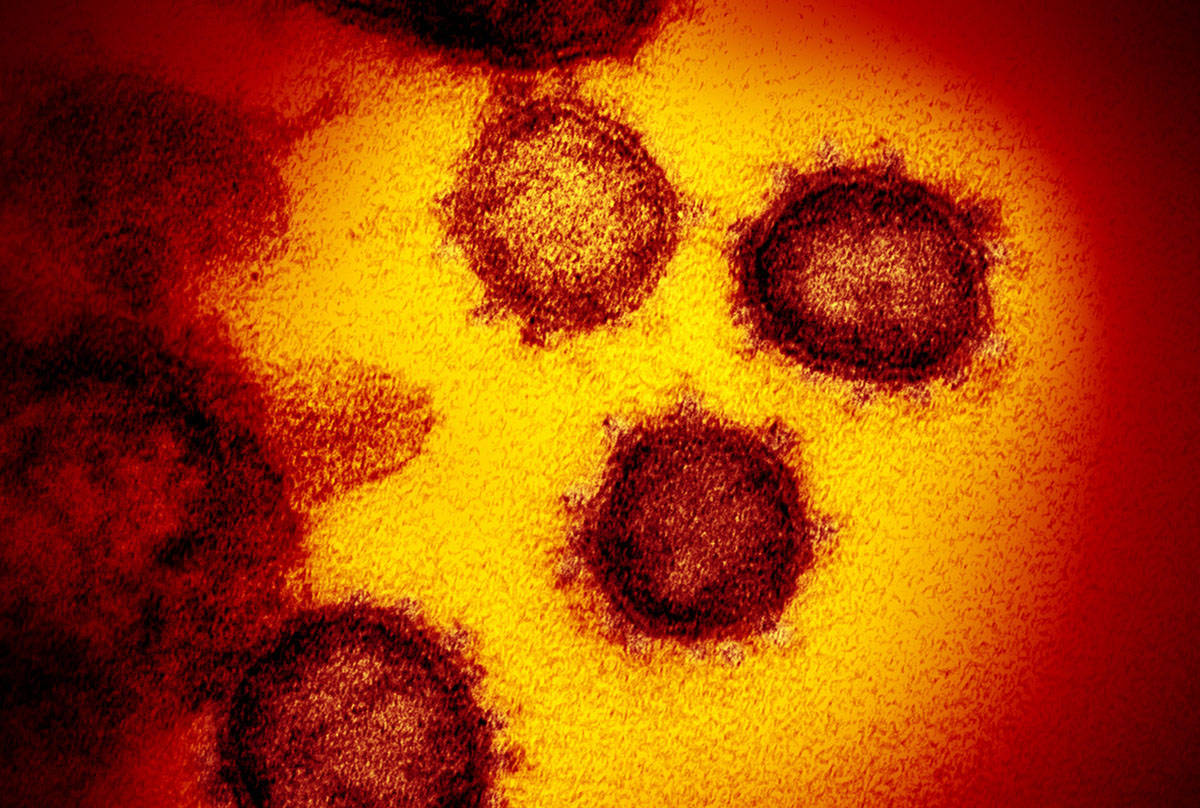 This image shows the Novel Coronavirus SARS-CoV-2. (NIAID-RML via AP)