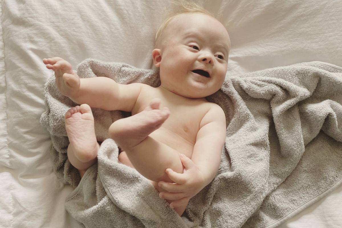 An undated photo of 9-month-old Caleb Anderson, who was tested for COVID-19 after his airway co ...