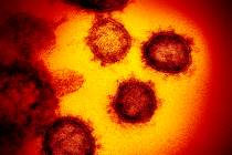 Novel Coronavirus SARS-CoV-2. (National Institutes of Health via AP)