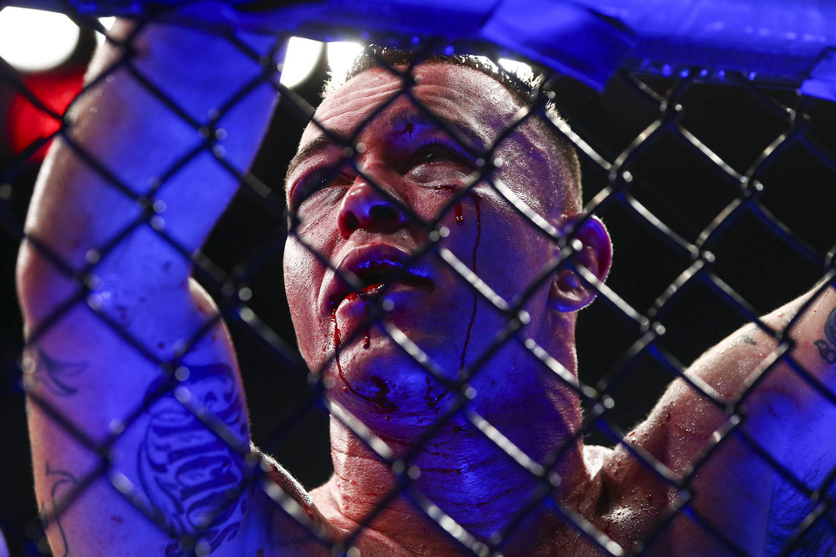Blood drips from the face of Colby Covington after losing via technical knockout to Kamaru Usm ...