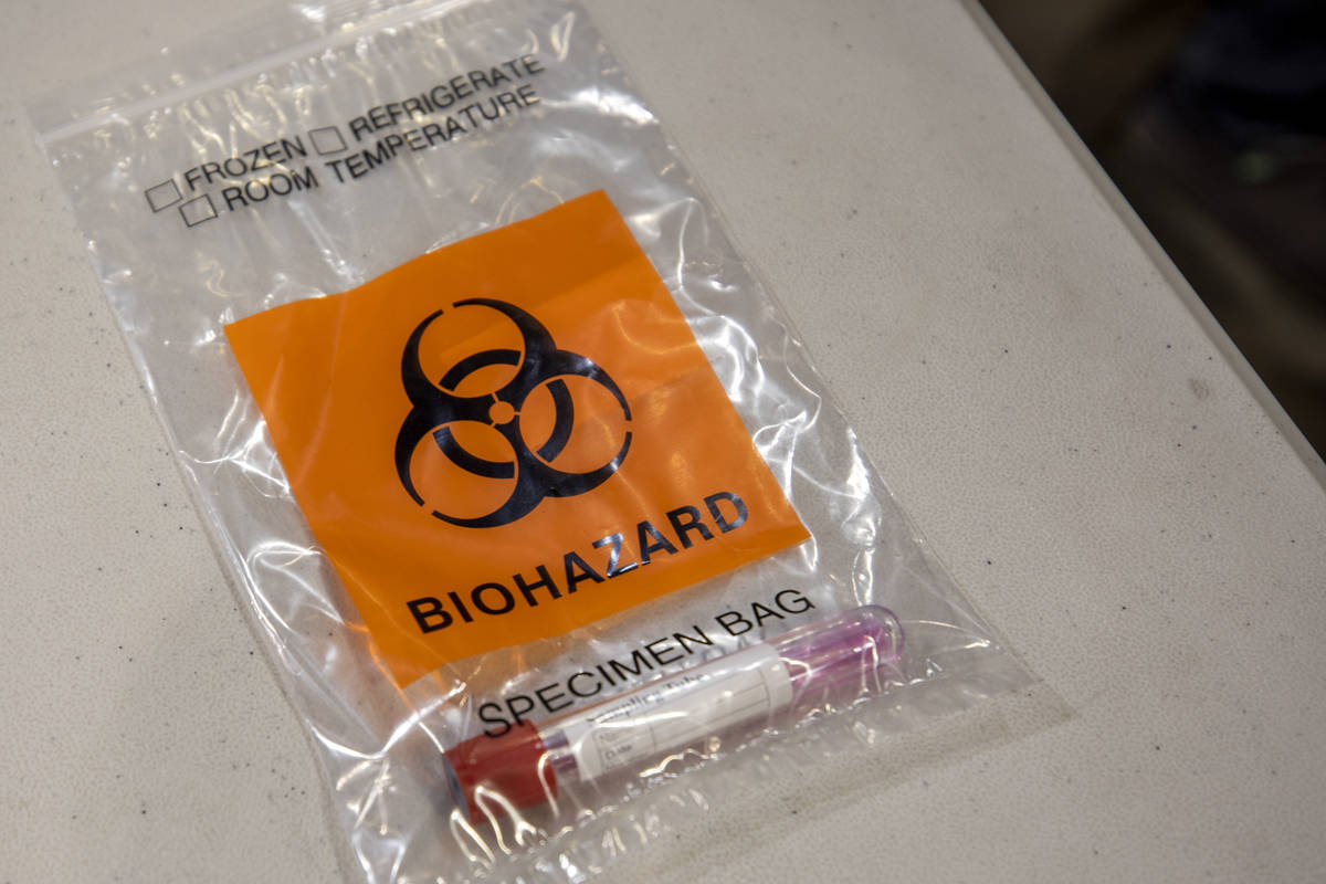A completed COVID-19 test in a biohazard bag during a preview of COVID-19 testing site at Cashm ...