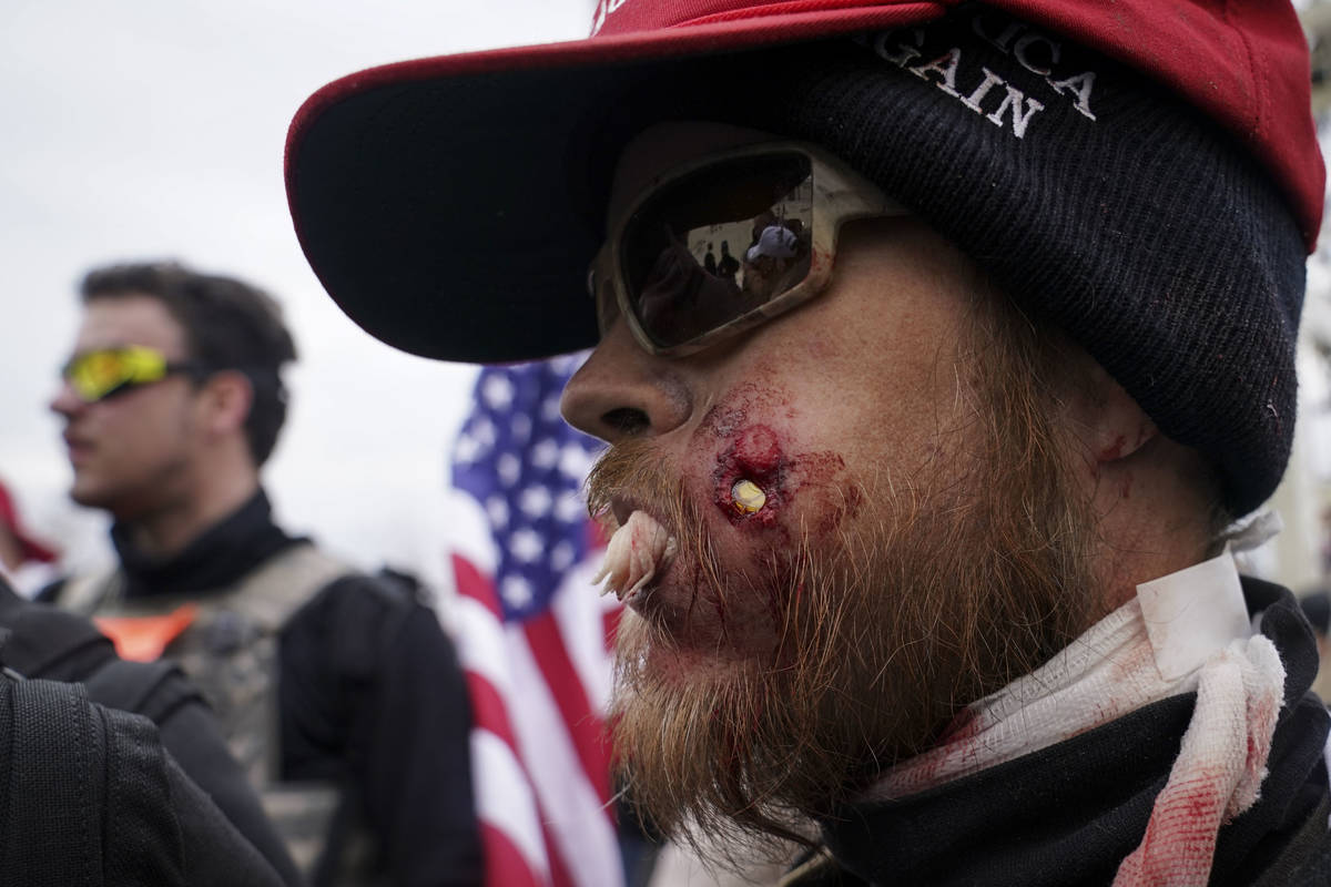 A protestor is shown injured during a confrontation with police during a rally Wednesday, Jan. ...