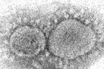This 2020 electron microscope image made available by the Centers for Disease Control and Preve ...