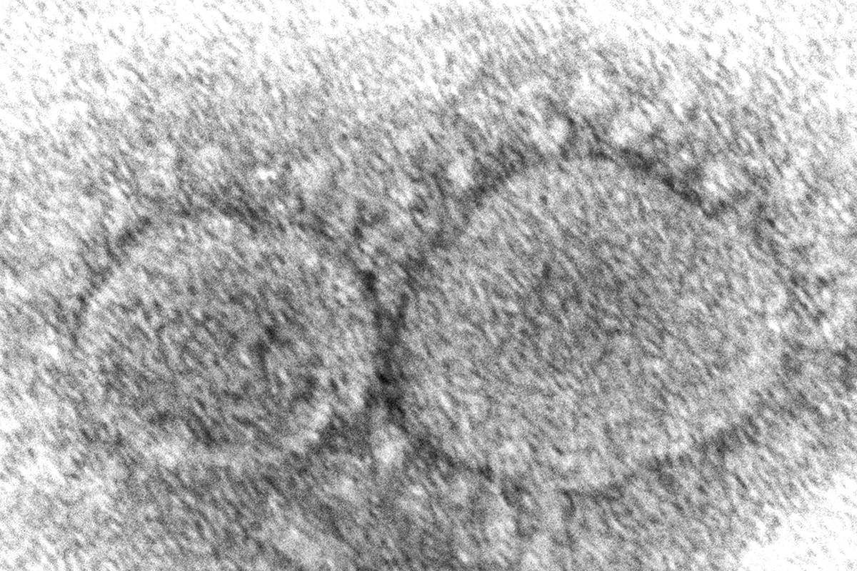 This 2020 electron microscope image made available by the Centers for Disease Control and Preve ...
