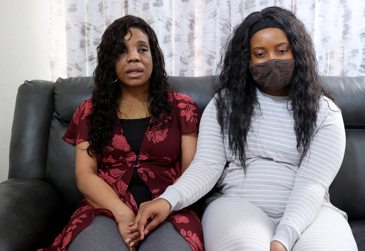 Latoshia Johnson, left, who struggles to open her eyes after a severe beating, talks to a repor ...