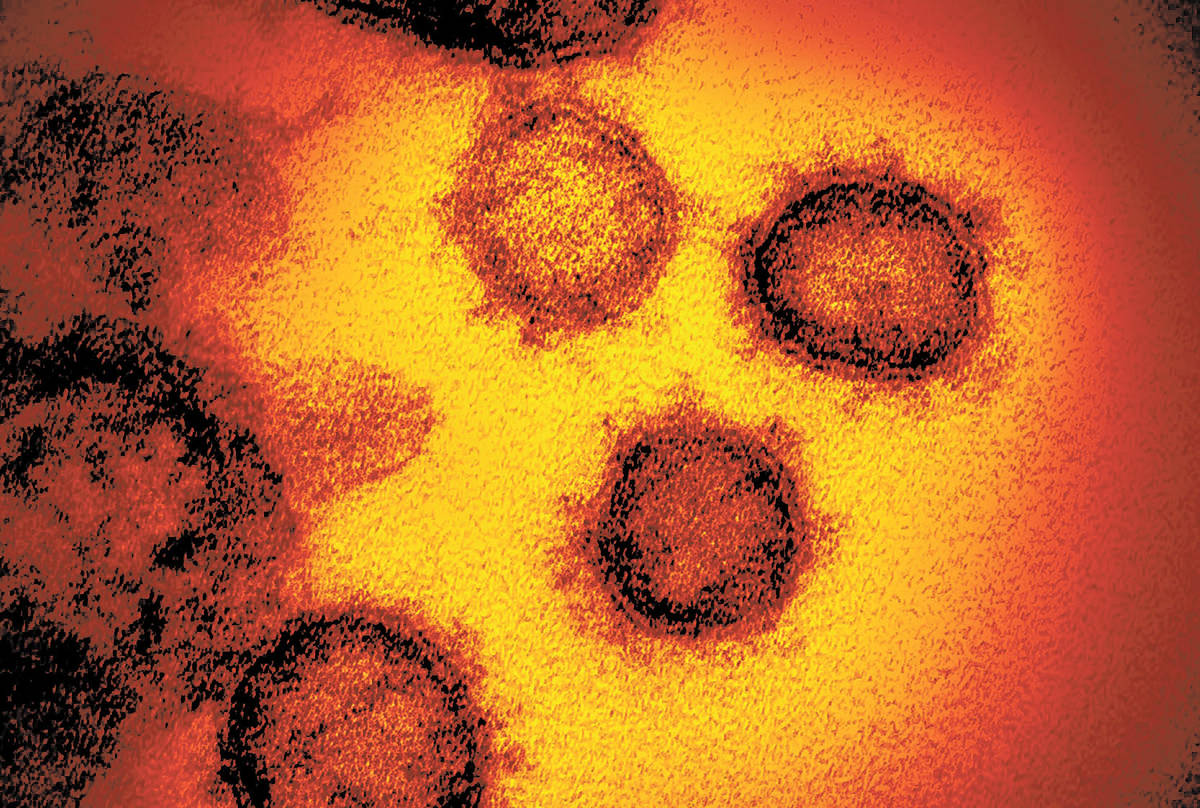 Brazil coronavirus variant found in Nevada