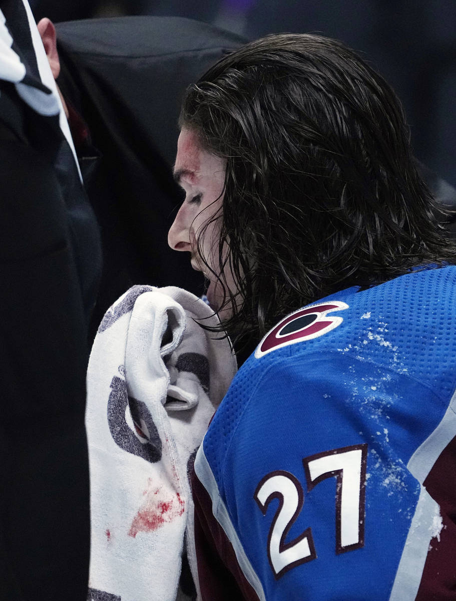 Colorado Avalanche defenseman Ryan Graves (27) wipes blood from his face after a fight against ...